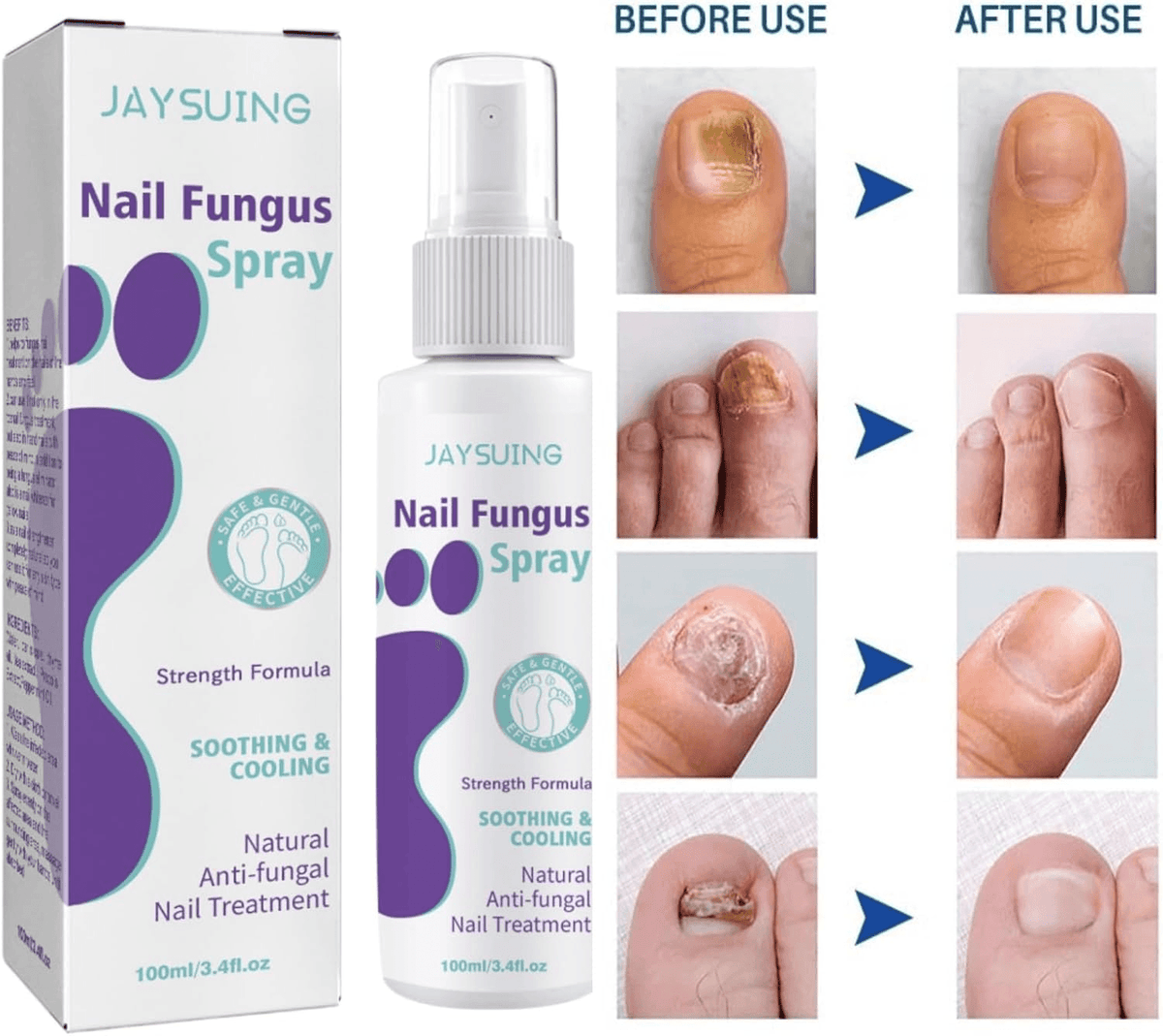 Extra Strong Nail Fungus Treatment Spray - 100ml Health & Beauty